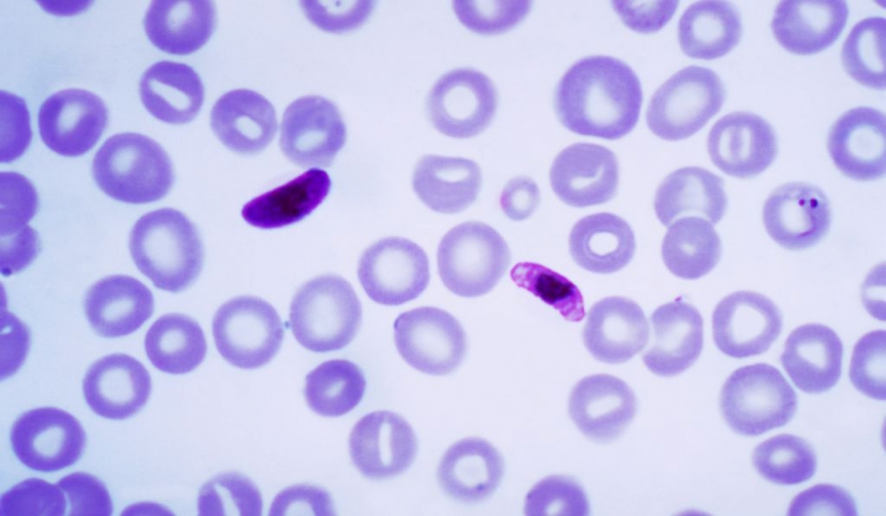 Лечим малярию с помощью напечатанного фильтра крови