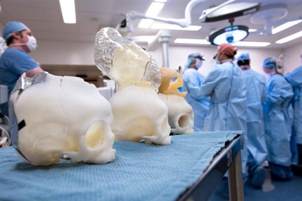 3д печать помогла хирургам спасти ребенка с мозгом вне черепа