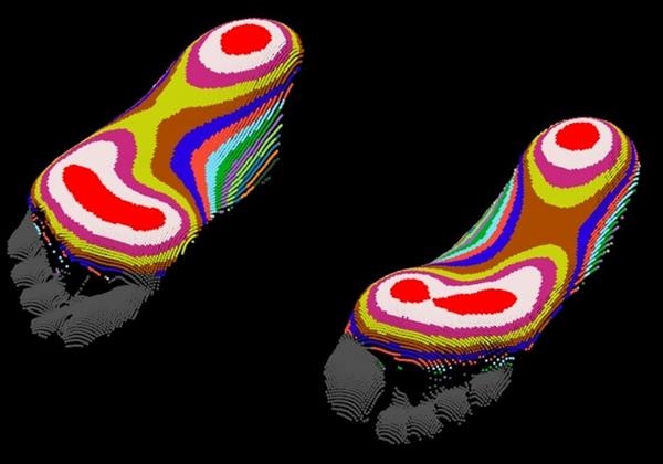 Напечатанные сандалии от OLT Footcare