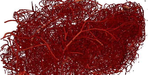 Напечатанные кровеносные сосуды для поддержания тканей