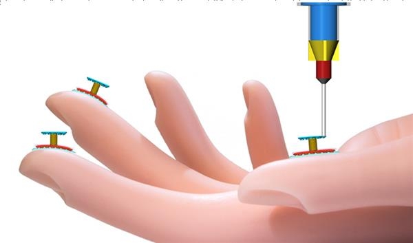 Печатаем сенсорный датчик на руку человека