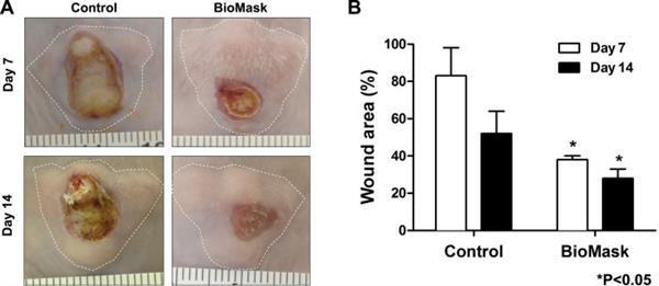 BioMask - маска для лечения и восстановления кожи лица после ожогов