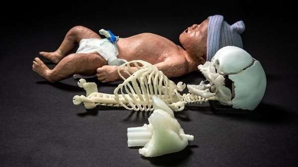 Напечатанный манекен новорожденного для подготовки неонатологов